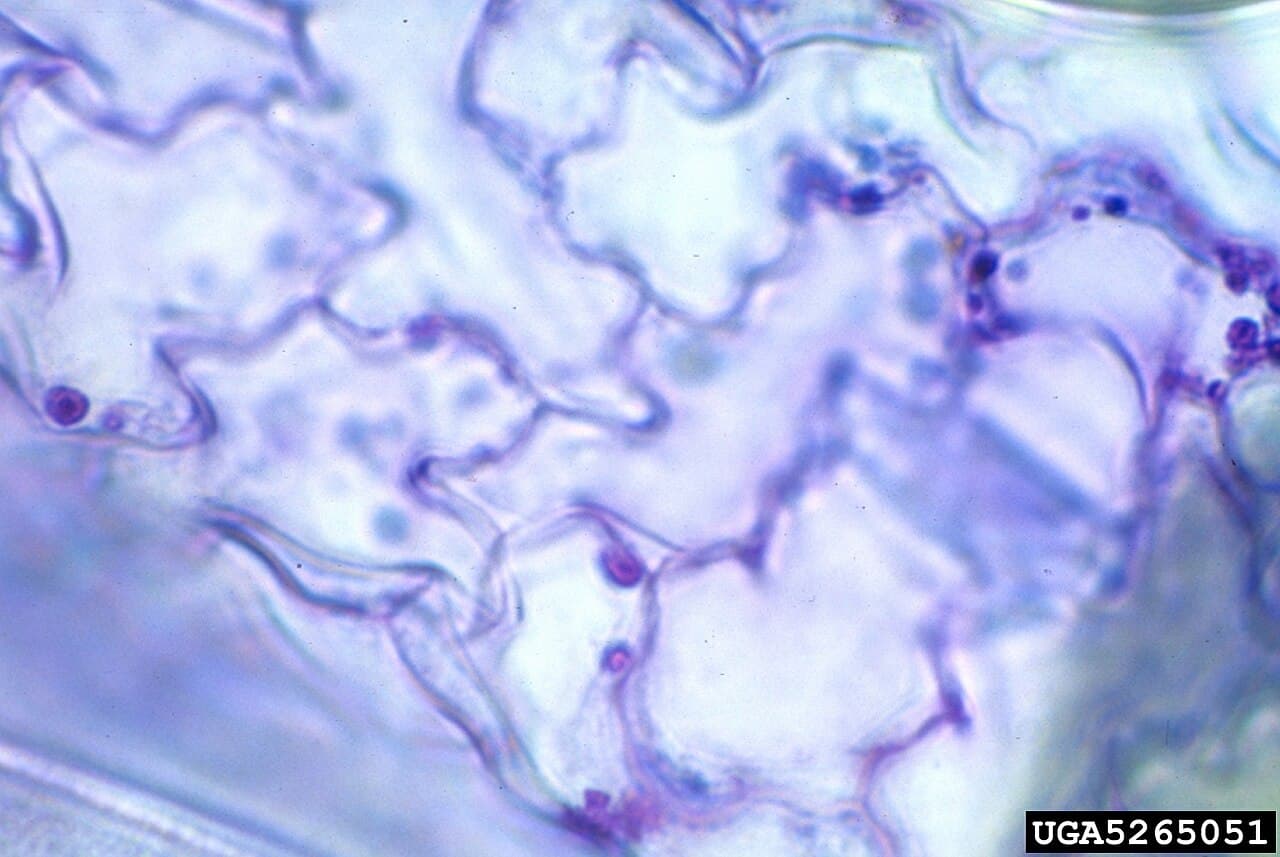 Imagine pentru Mozaicul castraveților: Cucumber mosiac virus inclusion bodies